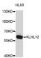 Kelch Like Family Member 12 antibody, STJ26949, St John