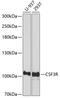 Colony Stimulating Factor 3 Receptor antibody, 23-088, ProSci, Western Blot image 