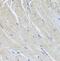 SRI antibody, FNab08228, FineTest, Immunohistochemistry paraffin image 