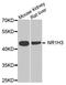 Nuclear Receptor Subfamily 1 Group H Member 3 antibody, A2141, ABclonal Technology, Western Blot image 