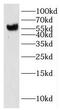 Inosine Monophosphate Dehydrogenase 2 antibody, FNab04303, FineTest, Western Blot image 