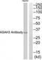 Alkaline Ceramidase 1 antibody, TA316075, Origene, Western Blot image 