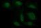 Catenin Beta 1 antibody, NBP2-46400, Novus Biologicals, Immunofluorescence image 