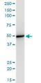 Eukaryotic Translation Initiation Factor 2 Subunit Beta antibody, H00008894-M09, Novus Biologicals, Western Blot image 