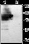 Potassium Voltage-Gated Channel Subfamily J Member 15 antibody, GTX16664, GeneTex, Western Blot image 