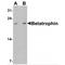 Angiopoietin Like 8 antibody, MBS153522, MyBioSource, Western Blot image 