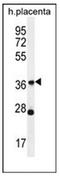 Olfactory Receptor Family 4 Subfamily L Member 1 antibody, AP53062PU-N, Origene, Western Blot image 