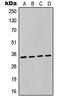 MAGE Family Member A6 antibody, LS-C352480, Lifespan Biosciences, Western Blot image 