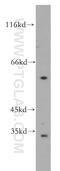 G Protein-Coupled Receptor 162 antibody, 15254-1-AP, Proteintech Group, Western Blot image 