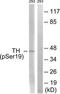 Tyrosine Hydroxylase antibody, TA313348, Origene, Western Blot image 