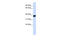 Lactate Dehydrogenase A antibody, 26-924, ProSci, Enzyme Linked Immunosorbent Assay image 