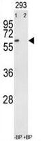 Receptor Like Tyrosine Kinase antibody, PA1-30713, Invitrogen Antibodies, Western Blot image 