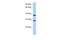 Kelch Domain Containing 1 antibody, GTX45587, GeneTex, Western Blot image 