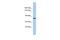 Kelch Like Family Member 32 antibody, A16287, Boster Biological Technology, Western Blot image 