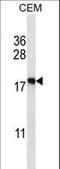 Eukaryotic Translation Initiation Factor 5A2 antibody, LS-C167715, Lifespan Biosciences, Western Blot image 