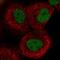 ABL Proto-Oncogene 1, Non-Receptor Tyrosine Kinase antibody, HPA027280, Atlas Antibodies, Immunofluorescence image 