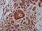 MDM2 Binding Protein antibody, LS-C672887, Lifespan Biosciences, Immunohistochemistry paraffin image 