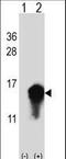 Cystatin A antibody, LS-C167108, Lifespan Biosciences, Western Blot image 