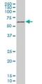 T-Box 18 antibody, H00009096-M04, Novus Biologicals, Western Blot image 