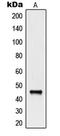 Natural Cytotoxicity Triggering Receptor 1 antibody, MBS821034, MyBioSource, Western Blot image 