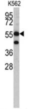 3-Hydroxy-3-Methylglutaryl-CoA Synthase 1 antibody, AP17474PU-N, Origene, Western Blot image 
