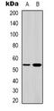Serum/Glucocorticoid Regulated Kinase 1 antibody, orb338879, Biorbyt, Western Blot image 