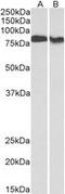 Protein Kinase C Beta antibody, MBS423034, MyBioSource, Western Blot image 