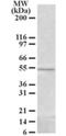 F-Box And Leucine Rich Repeat Protein 2 antibody, NB100-1289, Novus Biologicals, Western Blot image 