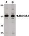 Aldehyde Dehydrogenase 3 Family Member A1 antibody, PA5-20602, Invitrogen Antibodies, Western Blot image 