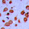Lemur Tyrosine Kinase 3 antibody, GTX56134, GeneTex, Immunohistochemistry paraffin image 