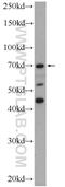 FAST Kinase Domains 3 antibody, 18392-1-AP, Proteintech Group, Western Blot image 