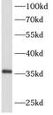 Axin Interactor, Dorsalization Associated antibody, FNab00234, FineTest, Western Blot image 