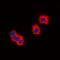 Interleukin 1 Receptor Associated Kinase 3 antibody, LS-C368869, Lifespan Biosciences, Immunofluorescence image 