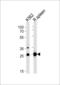 Solute Carrier Family 25 Member 37 antibody, LS-B13192, Lifespan Biosciences, Western Blot image 
