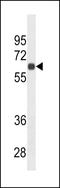 Syndecan 1 antibody, LS-B10172, Lifespan Biosciences, Western Blot image 