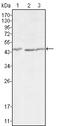 Dickkopf WNT Signaling Pathway Inhibitor 3 antibody, STJ98001, St John