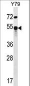 Zinc Finger Protein 14 antibody, LS-C160771, Lifespan Biosciences, Western Blot image 