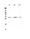 Kallikrein Related Peptidase 2 antibody, PA5-79567, Invitrogen Antibodies, Western Blot image 