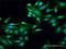 WT1 Interacting Protein antibody, H00126374-D01P, Novus Biologicals, Immunofluorescence image 