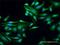 Wilms tumor protein 1-interacting protein antibody, H00126374-D01P, Novus Biologicals, Immunofluorescence image 