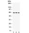 Secreted Phosphoprotein 1 antibody, R31935, NSJ Bioreagents, Western Blot image 