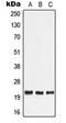 Lymphotoxin Alpha antibody, orb214204, Biorbyt, Western Blot image 