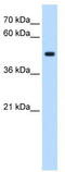 Serine/Threonine/Tyrosine Kinase 1 antibody, TA342379, Origene, Western Blot image 