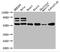 Citrate Synthase antibody, A52776-100, Epigentek, Western Blot image 