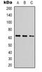 Far upstream element-binding protein 3 antibody, LS-C368701, Lifespan Biosciences, Western Blot image 