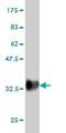 Prostate Stem Cell Antigen antibody, ab56338, Abcam, Western Blot image 