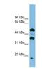 Heat Shock Protein Nuclear Import Factor Hikeshi antibody, NBP1-57764, Novus Biologicals, Western Blot image 