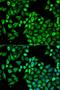 4-aminobutyrate aminotransferase, mitochondrial antibody, LS-B14889, Lifespan Biosciences, Immunofluorescence image 