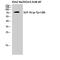 Lymphocyte Cytosolic Protein 2 antibody, A04880Y128-1, Boster Biological Technology, Western Blot image 