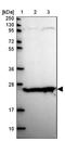 Tumor Protein P63 Regulated 1 antibody, NBP2-13471, Novus Biologicals, Western Blot image 